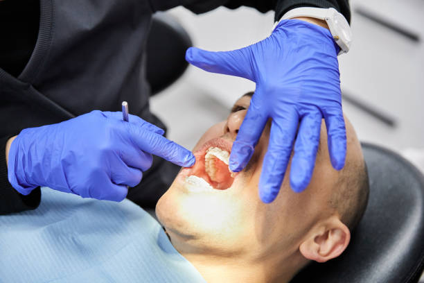 Best Same-Day Emergency Dental Services in Port Hadlock Irondale, WA
